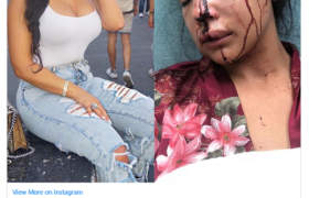 Buffalo Bills running back LeSean McCoy has been accused of brutally beating his girlfriend Delicia Cordon